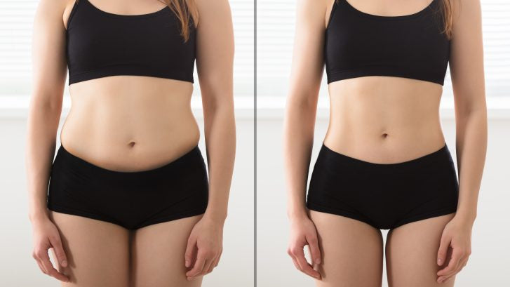 NON SURGICAL LIPO cavitation